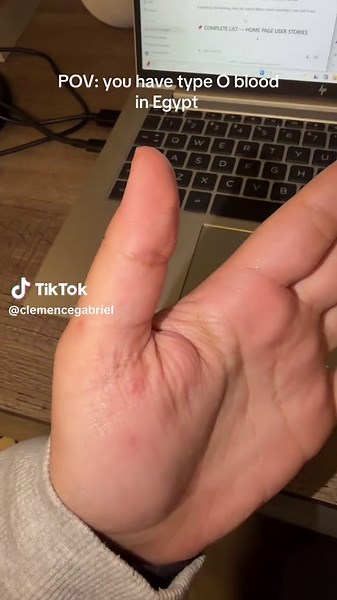 Living with Type O Blood in Egypt: Mosquitoes Beware