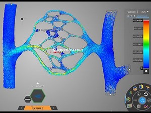 Hemodynamics of Free and Obstructed Blood Flow Through Capillaries - ANSYS Discovery 2021 R1