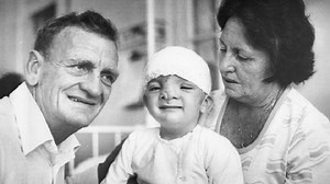 When This Newborn’s Mother First Saw His Severely Deformed Face, She Actually Wished He Would Die