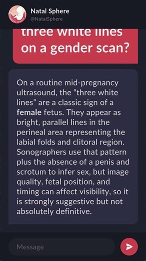 What are the three white lines on a gender scan?