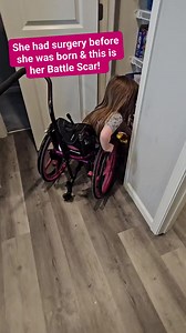 88K views · 9.9K reactions | She had fetal repair surgery for Spina Bifida! #Awareness #BirthDefects #Spinabifida #miracle #Overcome #inspiration | Michael Bower | Facebook