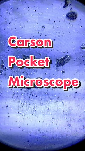Exploring Micro Worlds: Puddle Water Under Carson Pocket Microscope
