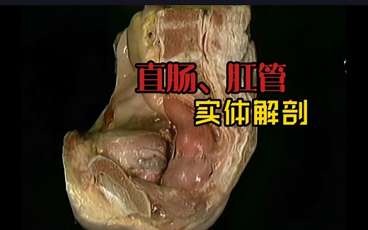 大体解剖: 直肠、肛管