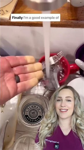 What happened to his fingers?!