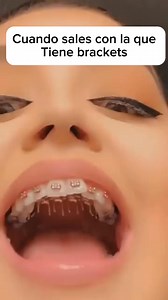 3.6K views · 208K reactions |  #humor #risas #jaja #brackets | Alan Parra | Facebook