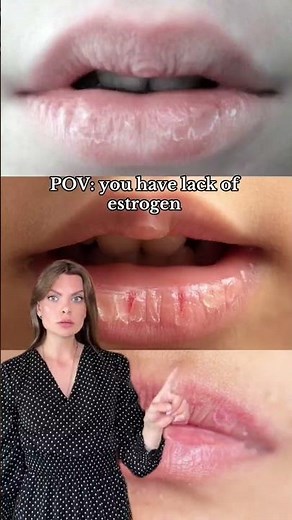 ⚠️ Low Estrogen Symptoms You Shouldn’t Ignore