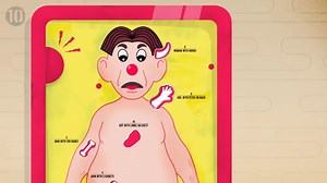 10 People Born With Extra Body Parts, From Two Penises To A Set Of Horns