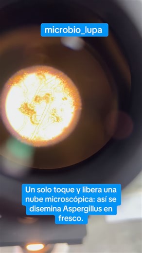 Microbiology on Instagram: "Preparación en fresco donde se observan hifas hialinas, delgadas y septadas, con estructuras conidiales en forma de “cabezas” globosas. De los conidióforos emergen vesículas terminales cubiertas por fiálides que producen abundantes conidios redondos, visibles como múltiples esferas libres alrededor de cada cabeza. Esta disposición en racimos de esporas explica su fácil dispersión en el aire ante la mínima perturbación de la muestra. #microbio_lupa @microbio_lupa"
