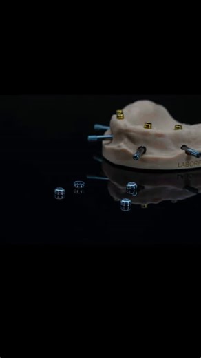 💙¿Sabías que hoy en día una prótesis dental puede ser mucho más cómoda y segura que antes? Esto es gracias al sistema Locator, un aditamento que se instala sobre el implante. 🔒 ¿El resultado? La prótesis queda firme y estable, evitando que se mueva al hablar, reír o comer. A la vez, es muy fácil de quitar y poner para su limpieza diaria. En pocas palabras: ➡️ Más confianza. ➡️ Más comodidad. ➡️ Más calidad de vida. Sonrisa fija con las ventajas de una removible. ✨ #sistemalocator #locatorsyste