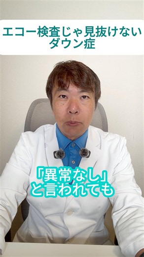 ダウン症はエコー検査じゃ100%は見抜けない？