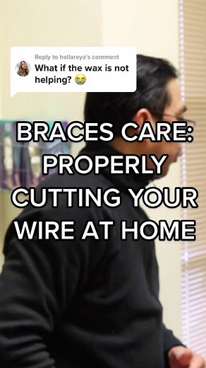 Braces Wire Cutting: How to Safely Trim Excess Wire at Home