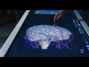 Stroke Awareness — Neurovascular Disease Explained