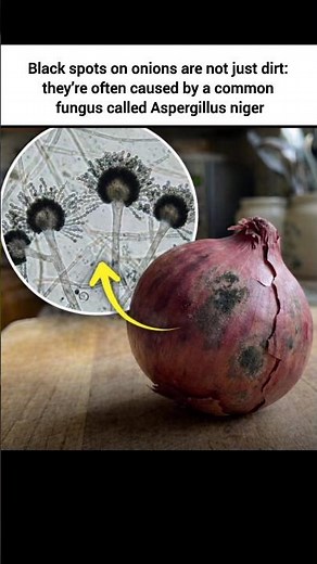 Do you know this black spots can be lethal | Aspergillus niger | Dr Abhishek Pathak