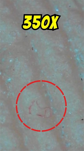 fingers under the microscope | micro view #microscope #biology #science #youtubeshorts