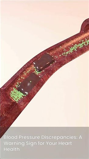 Why You Should Check Your Blood Pressure in Both Arms 🩺 | RN Explains 123