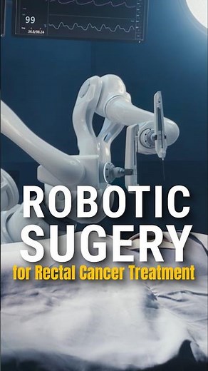 Robotic Surgery for Rectal Cancer Treatment #roboticsurgery #rectalcancer