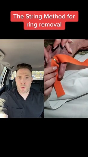 35K views · 917 reactions | How do you remove a ring when your finger is too swollen You use the string method! #doctor #constipation #fiber #nutrition #medical #growthmindset #ambulance #emergency #healthcare #doctorreact #residency #Psychologist #skincare #healthy #medicine #cancer #chiropractic #pimplepopper | Doctor Joe | Facebook
