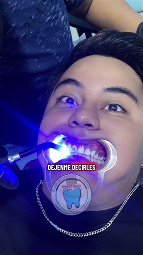 Me puse brakets en la clínica de Javier Escobar