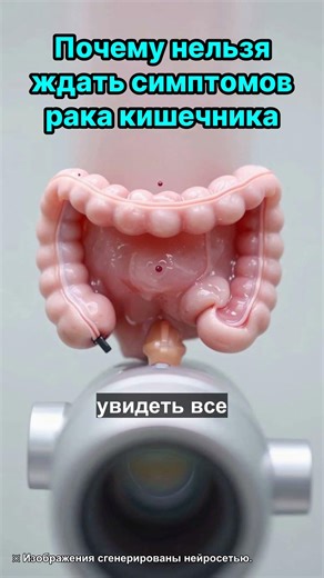 Рак толстой кишки эндоскопия самый надежный способ профилактики через удаление полипов