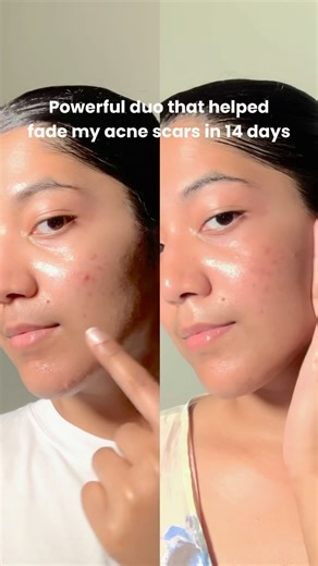 I tested the Foxtale 12% Niacinamide serum + Oil Balancing moisturizer 🩷 | My honest review