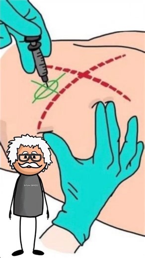 Intramuscular (IM) Injection #shorts