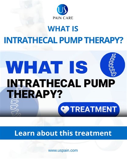 US Pain Care | Treatment Focus: What Is Intrathecal Pump Therapy Intrathecal Pump Therapy is an advanced pain management treatment designed for patients... | Instagram