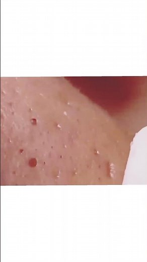 Achieve Inner Peace with These Soothing Facial Cleansing Methods | Relax & Rejuvenate.