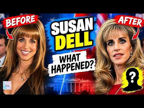 Susan Dell Before and After: Why Is Everyone Talking About Her?