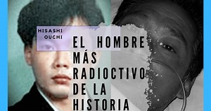 The tragic story of Hisashi Ouchi, man who suffered the largest radioactive charge in history