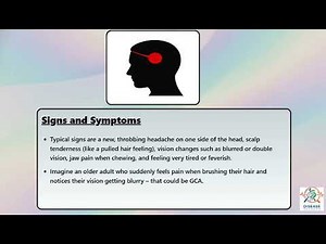 Giant Cell Arteritis Explained Causes, Symptoms and Treatment, All Insights
