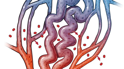 Oral medication improves quality of life for patients with rare vascular disorder