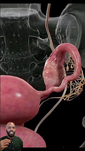 This is how a subdermal contraceptive implant is inserted