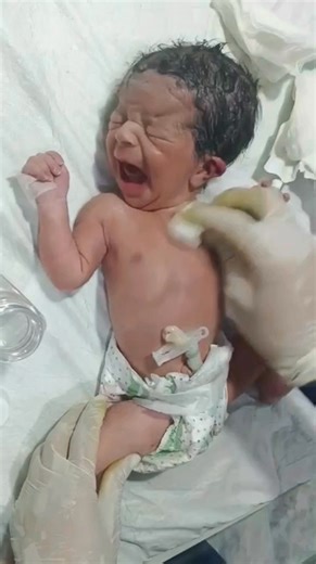 newborn LBW baby good condition and reflux check with initial care #refluxbaby #cutestbaby #newbornbaby | Boom Boom Studio Babies