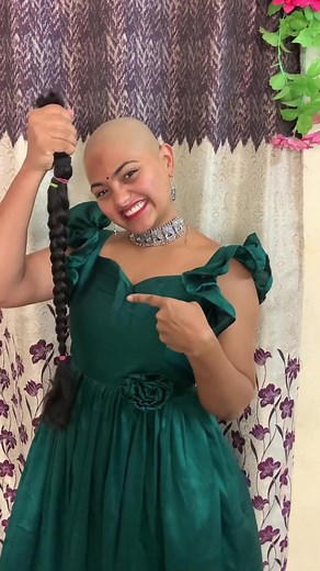 Embracing Baldness: A Journey to Self-Acceptance