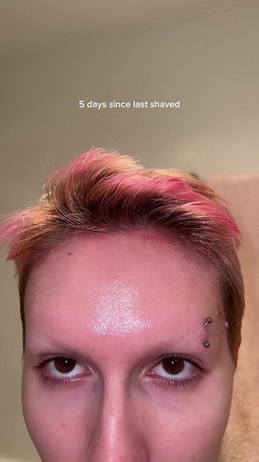 Eyebrow Regrowth Progress: 5/6 Weeks Journey