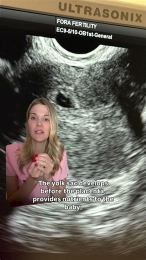 At a 5-week ultrasound, things are just getting started and that’s normal