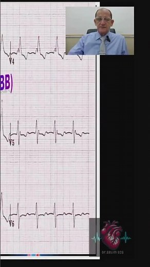 Right bundle branch block ECG (13)