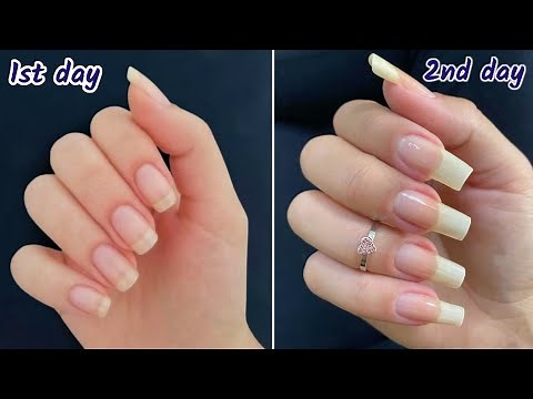 How to grow nails in 2 days || How to grow nails fast || How to grow nails fast overnight ||