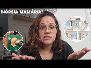 BIÓPSIA MAMARIA - MAMOTOMIA - BI RADS 4