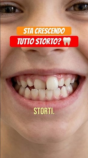 Are your teeth all growing in crooked? Braces, yes or no? Let's talk about it! @DentalBios