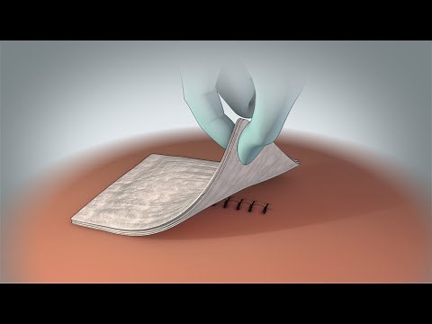 Incision Care Discharge Instructions | Nucleus Health