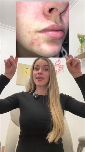 Dermatología: Beneficios de la Centella Asiática