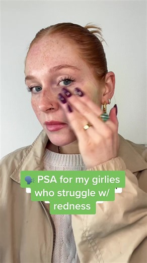 Hero Rescue Balm Red Correct Review: Bye Bye Redness 👋