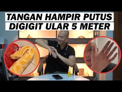 WHY DOES THIS HAPPEN AND WHAT SHOULD I DO? BITED BY A 5-METER SNAKE!