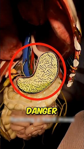 Eating Uncooked Instant Noodles? Here’s What Happens Inside Your Body 😨