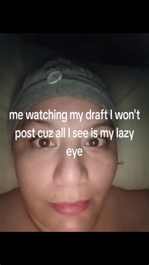 Understanding Lazy Eyes and Their Impact