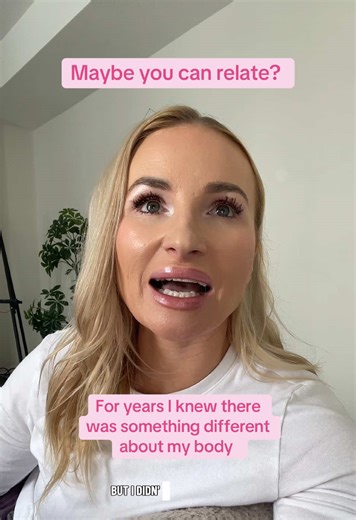 For years, I knew something was different about my body but I didn’t have the language to explain it. My legs were heavy, painful, tender to the touch. I bruised easily, often with no explanation. My calves grew disproportionately, and no amount of dieting or exercise changed them. From the outside, it looked like I wasn’t trying hard enough. On the inside, I was living with daily pain, swelling, confusion and eventually, self-doubt. Like so many women, I was repeatedly dismissed by the medical 