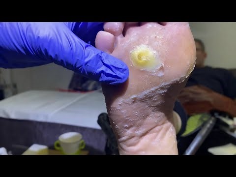 Corn with a core (Root corn)