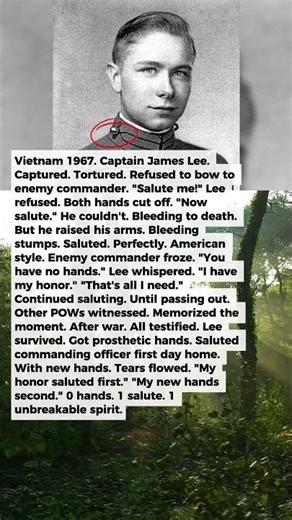 They Cut Off His Hands So He Couldn't Salute. He Saluted With His Bleeding Stumps Anyway | Military