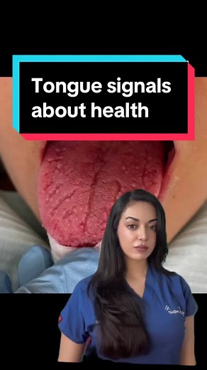 Tongue Health Signals: Understanding Tongue Changes for Better Health